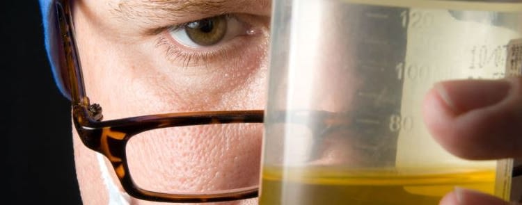 Ways of Passing a Urine Drug Test Ways of Passing a Urine Drug Test