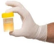 drug test