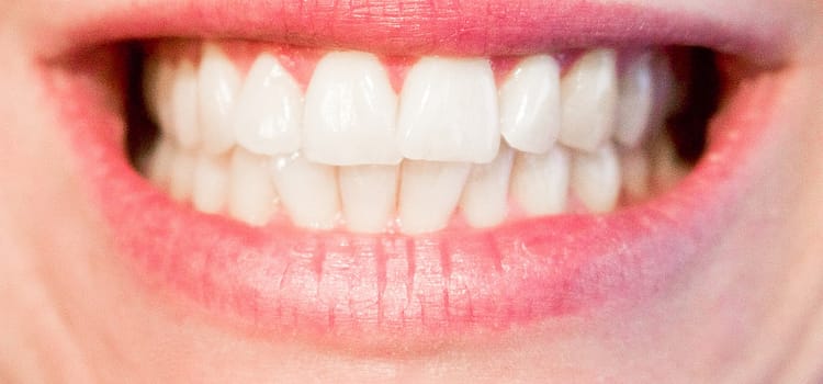 white teeth